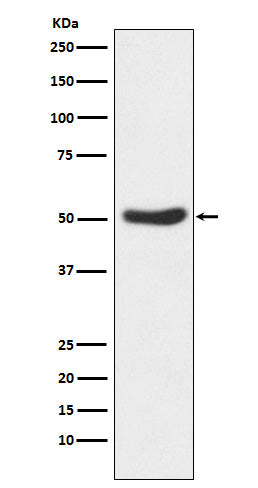 Anti-GSK3 alpha Rabbit Monoclonal Antibody Boster Bio