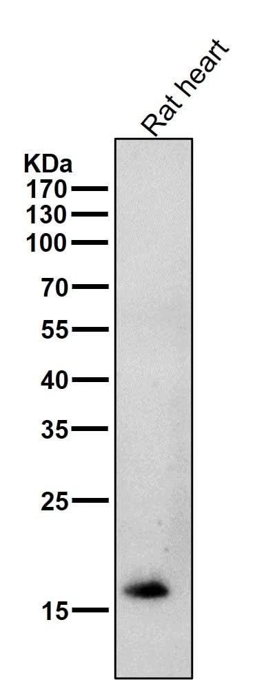 Anti-Cardiac Troponin C Rabbit Monoclonal Antibody Boster Bio