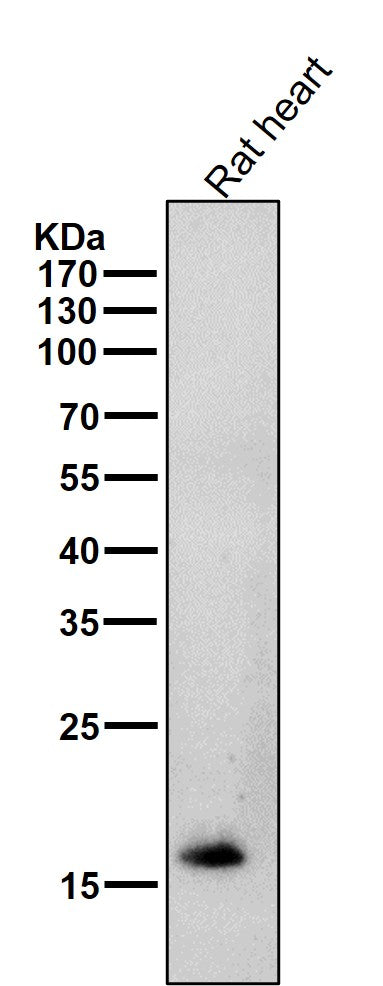 Anti-Cardiac Troponin C Rabbit Monoclonal Antibody Boster Bio
