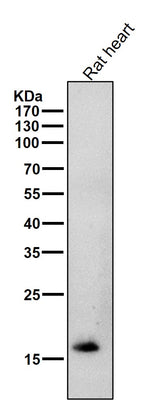 Anti-Cardiac Troponin C Rabbit Monoclonal Antibody Boster Bio