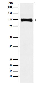 Anti-PIWIL1 Rabbit Monoclonal Antibody Boster Bio