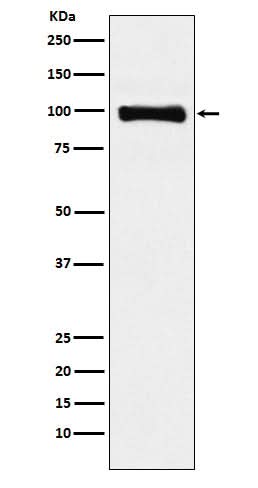 Anti-PIWIL1 Rabbit Monoclonal Antibody Boster Bio