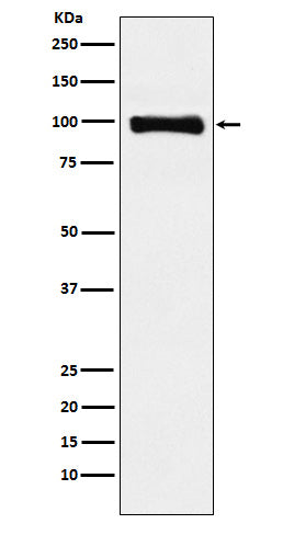 Anti-PIWIL1 Rabbit Monoclonal Antibody Boster Bio