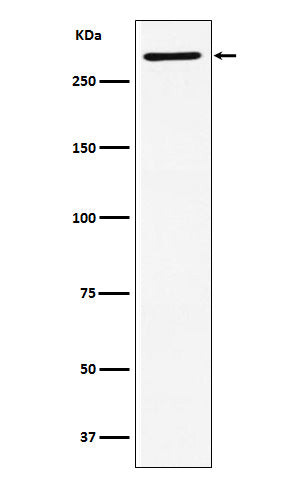Anti-EDD Rabbit Monoclonal Antibody Boster Bio