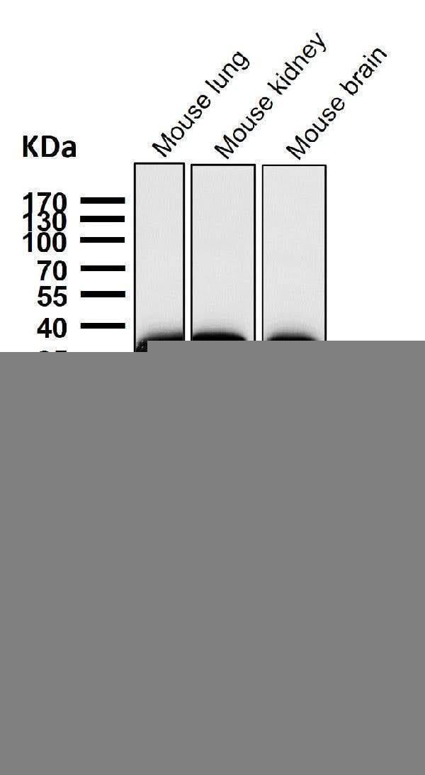 Anti-Gamma glutamyl hydrolase Rabbit Monoclonal Antibody Boster Bio