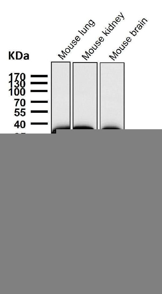 Anti-Gamma glutamyl hydrolase Rabbit Monoclonal Antibody Boster Bio
