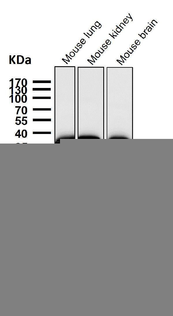 Anti-Gamma glutamyl hydrolase Rabbit Monoclonal Antibody Boster Bio
