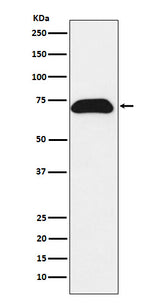 Anti-PDZK1 Rabbit Monoclonal Antibody Boster Bio