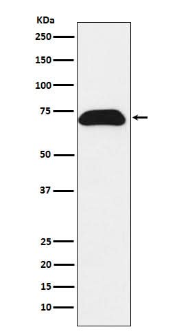 Anti-PDZK1 Rabbit Monoclonal Antibody Boster Bio