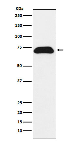 Anti-PDZK1 Rabbit Monoclonal Antibody Boster Bio