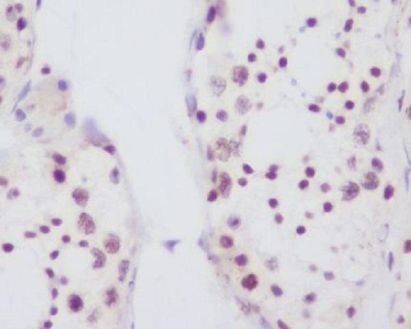 Anti-Fibrillarin FBL Rabbit Monoclonal Antibody Boster Bio