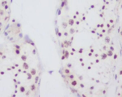 Anti-Fibrillarin FBL Rabbit Monoclonal Antibody Boster Bio