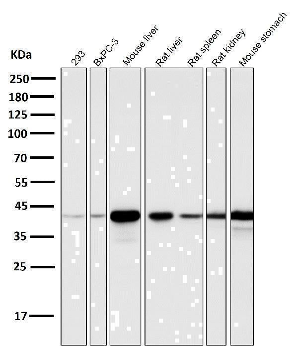 Anti-Glutamine Synthetase GLUL Rabbit Monoclonal Antibody Boster Bio
