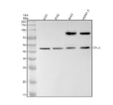 Anti-Calumenin Rabbit Monoclonal Antibody Boster Bio