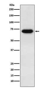 Anti-CD39 Rabbit Monoclonal Antibody Boster Bio