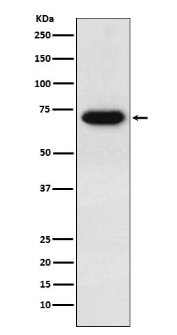 Anti-CD39 Rabbit Monoclonal Antibody Boster Bio