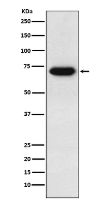 Anti-CD39 Rabbit Monoclonal Antibody Boster Bio