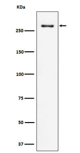 Anti-CHD3 Rabbit Monoclonal Antibody Boster Bio