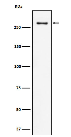 Anti-CHD3 Rabbit Monoclonal Antibody Boster Bio