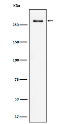 Anti-CHD3 Rabbit Monoclonal Antibody Boster Bio