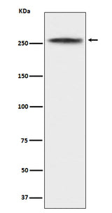 Anti-CHD3 Rabbit Monoclonal Antibody Boster Bio