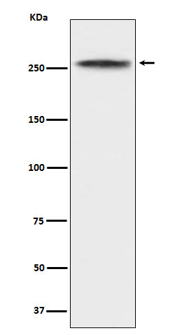Anti-CHD3 Rabbit Monoclonal Antibody Boster Bio