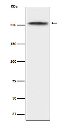 Anti-CHD3 Rabbit Monoclonal Antibody Boster Bio