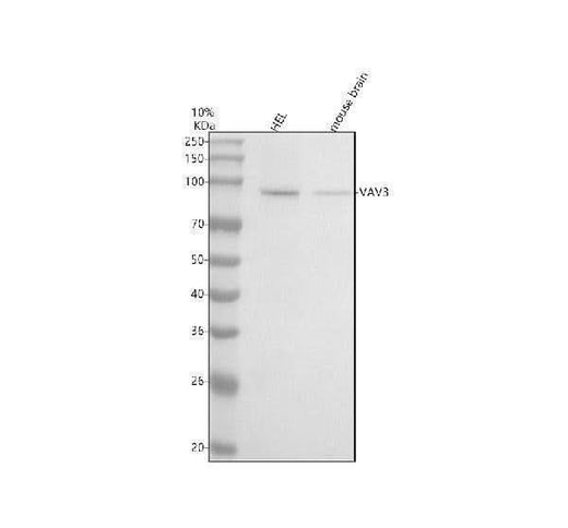 Anti-VAV3 Rabbit Monoclonal Antibody Boster Bio