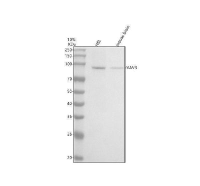 Anti-VAV3 Rabbit Monoclonal Antibody Boster Bio