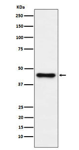 Anti-ABHD5 Monoclonal Antibody Boster Bio