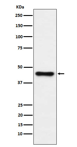 Anti-ABHD5 Monoclonal Antibody Boster Bio