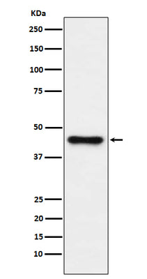 Anti-ABHD5 Monoclonal Antibody Boster Bio