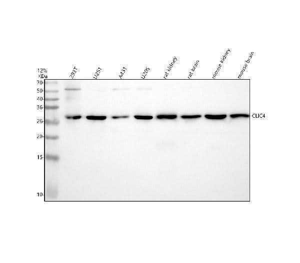 Anti-CLIC4 Rabbit Monoclonal Antibody Boster Bio
