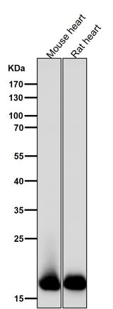 Anti-Myosin Light Chain 2 Rabbit Monoclonal Antibody Boster Bio