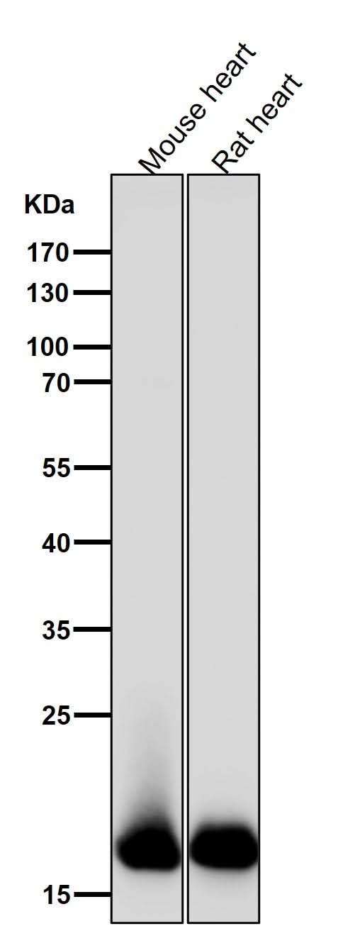 Anti-Myosin Light Chain 2 Rabbit Monoclonal Antibody Boster Bio