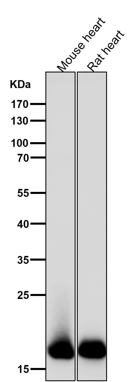 Anti-Myosin Light Chain 2 Rabbit Monoclonal Antibody Boster Bio
