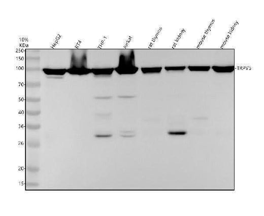 Anti-TRPV5 Rabbit Monoclonal Antibody Boster Bio