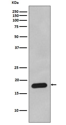 Anti-Cyclophilin B PPIB Rabbit Monoclonal Antibody Boster Bio