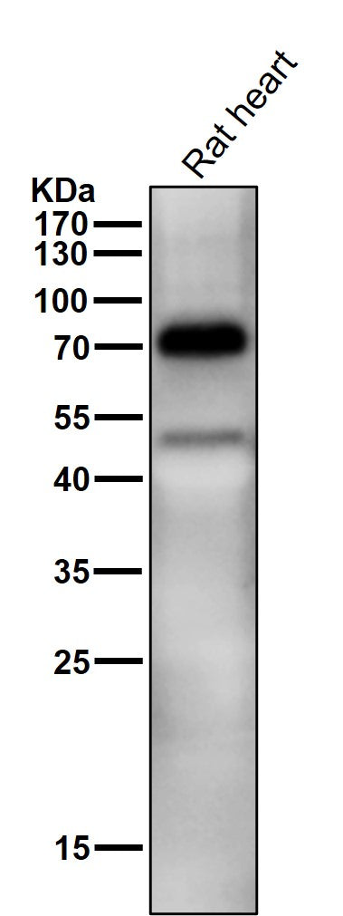 Anti-TRIM25 Monoclonal Antibody Boster Bio