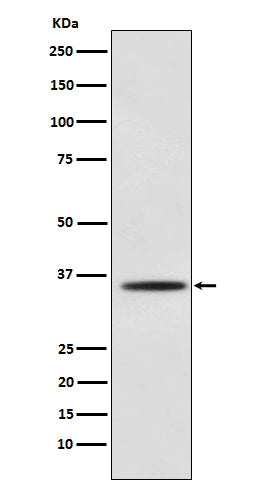 Anti-Myogenin Monoclonal Antibody Boster Bio