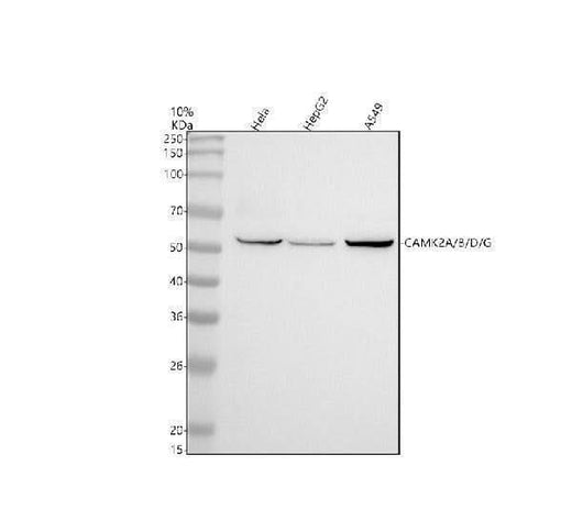 Anti-CaMKII Rabbit Monoclonal Antibody Boster Bio