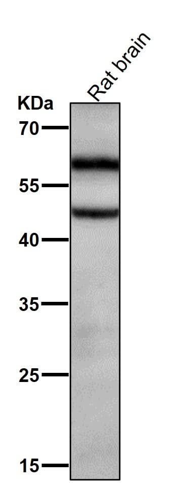 Anti-Phospho-CaMKII alpha (T286) Rabbit Monoclonal Antibody Boster Bio