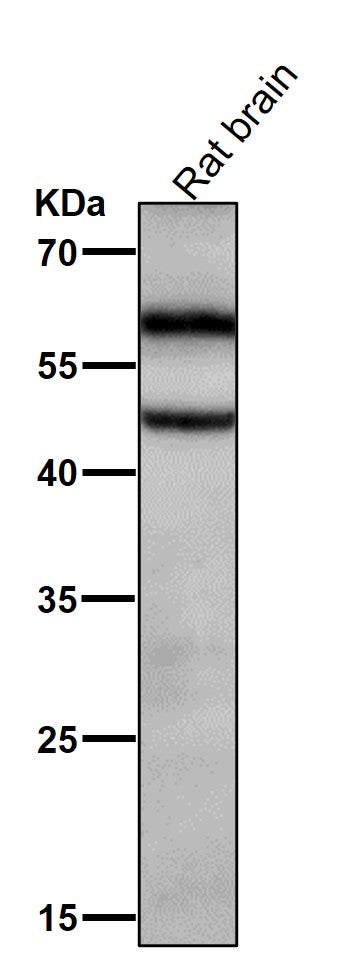 Anti-Phospho-CaMKII alpha (T286) Rabbit Monoclonal Antibody Boster Bio