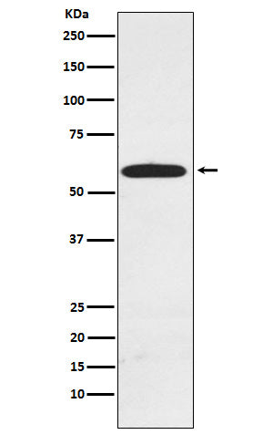 Anti-RAD23A Rabbit Monoclonal Antibody Boster Bio