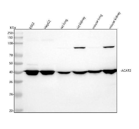 Anti-ACAT2 Rabbit Monoclonal Antibody Boster Bio