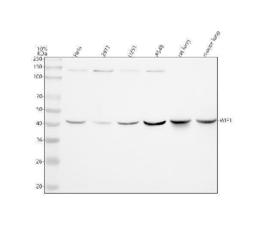 Anti-WIF1 Rabbit Monoclonal Antibody Boster Bio