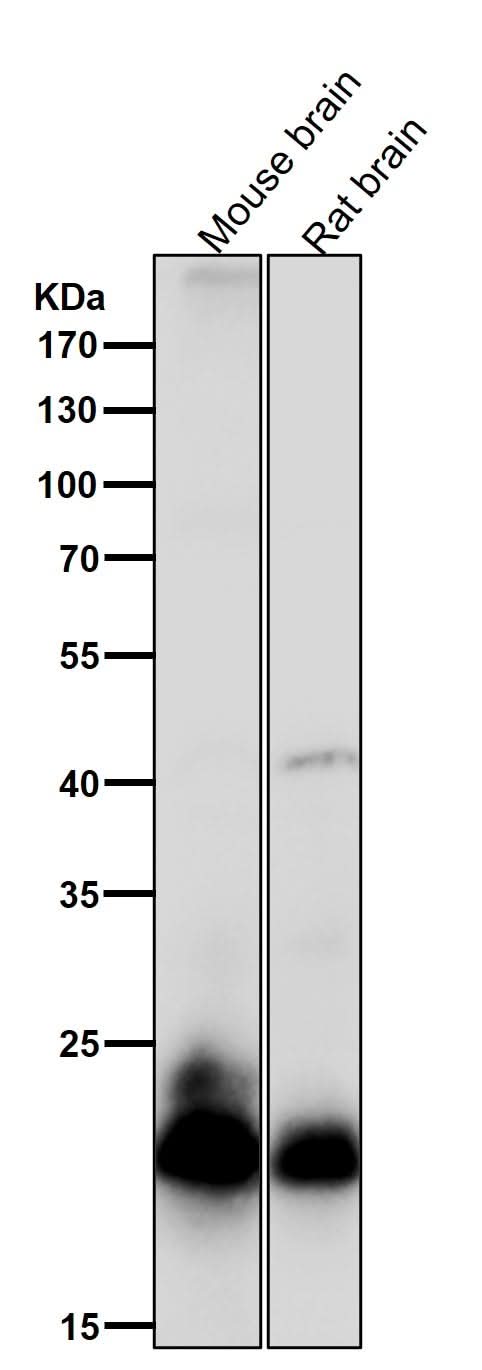 Anti-RAC3 Rabbit Monoclonal Antibody Boster Bio
