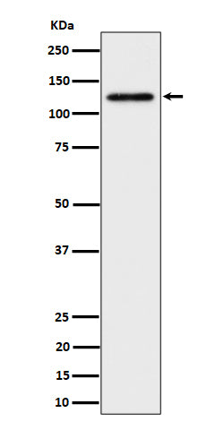 Anti-SPINK5 / LEKTI Rabbit Monoclonal Antibody Boster Bio