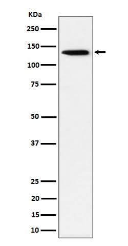 Anti-TRIM24 Rabbit Monoclonal Antibody Boster Bio