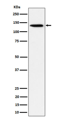Anti-TRIM24 Rabbit Monoclonal Antibody Boster Bio